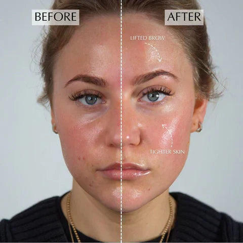 3-in-1 Anti-Aging Face Massager
